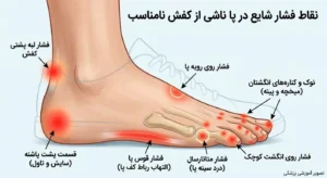 کدام قسمت‌های کفش بیشتر پا را می‌زنند؟